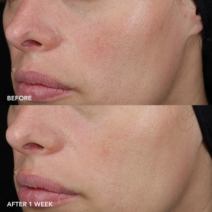 Image Skincare: MD Biotech Logevity Cr`eme,Clinically Proven to Firm Hydrate,improve elasticity and strenghten the skin in just weeks.