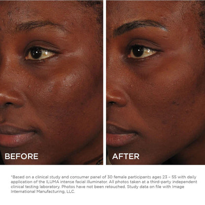 Image Skincare Iluma Intense Facial Illuminator