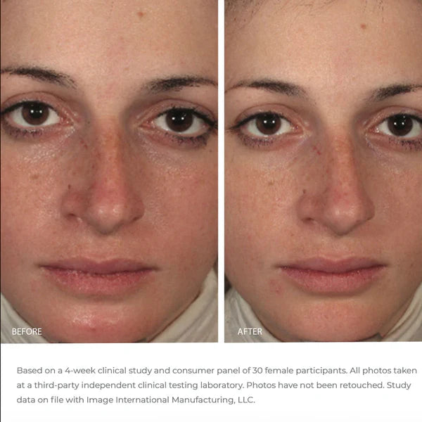 Image Skincare Ormedic Balancing Gel Masque