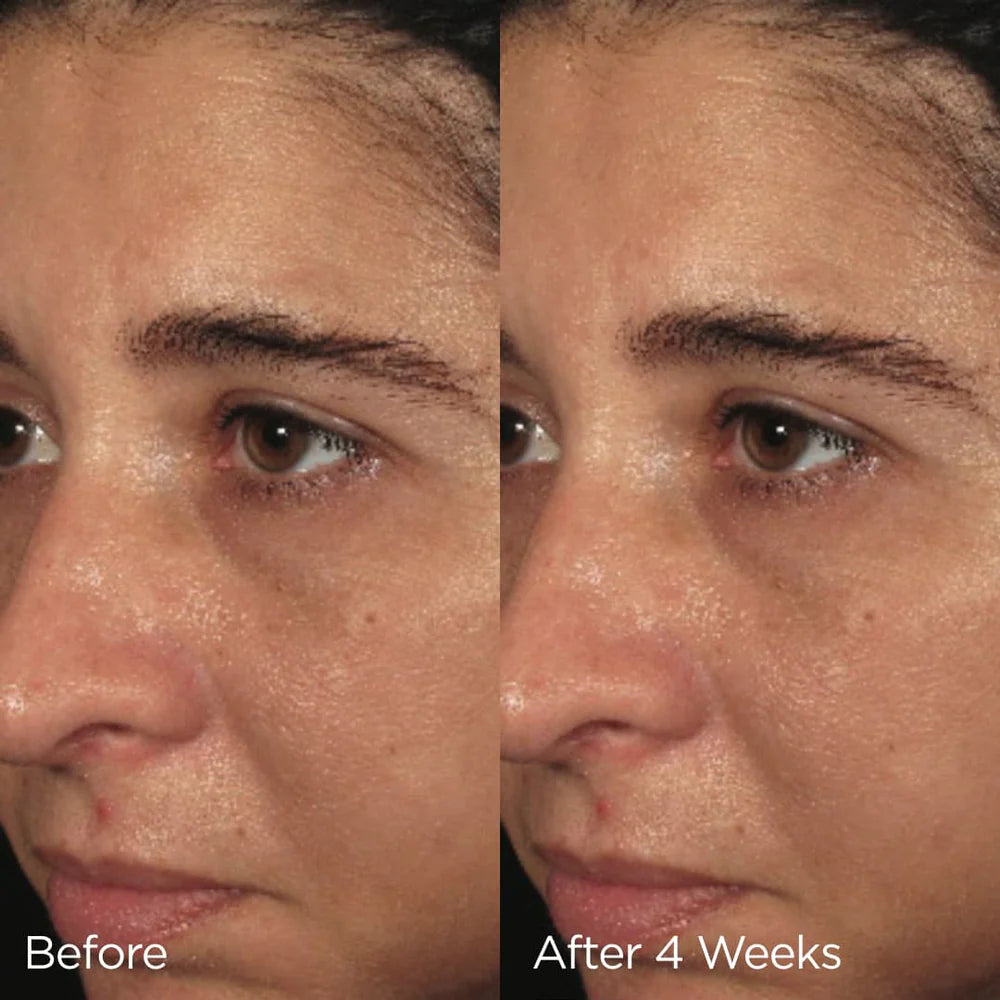 Image Skincare Ormedic Balancing Biopeptide Creme