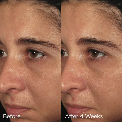 Image Skincare Ormedic Balancing Biopeptide Creme