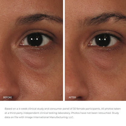 Image Skincare Ormedic Balancing Eye Lift Gel